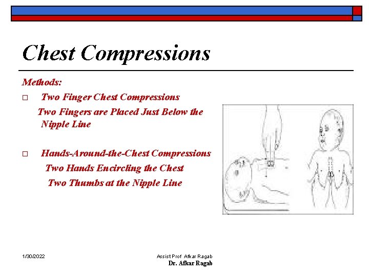 Chest Compressions Methods: o Two Finger Chest Compressions Two Fingers are Placed Just Below