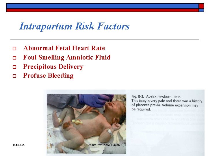 Intrapartum Risk Factors o o Abnormal Fetal Heart Rate Foul Smelling Amniotic Fluid Precipitous