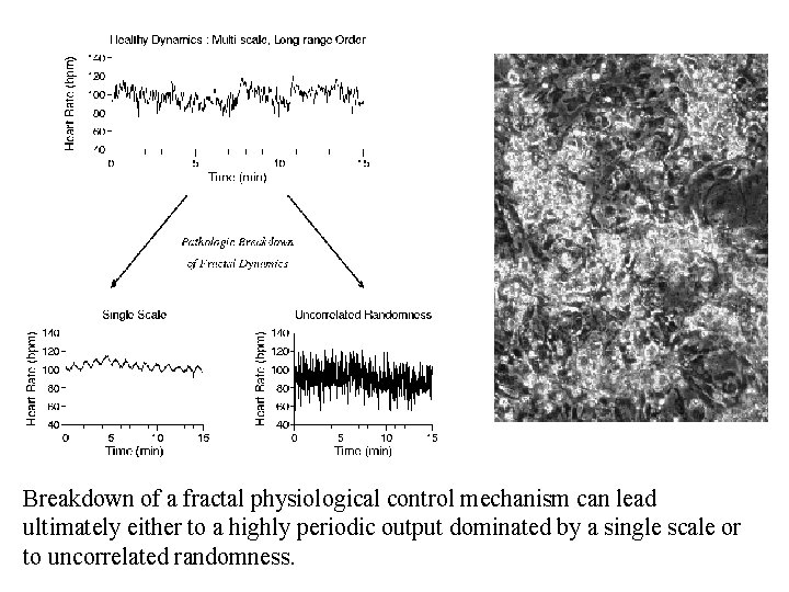 Breakdown of a fractal physiological control mechanism can lead ultimately either to a highly