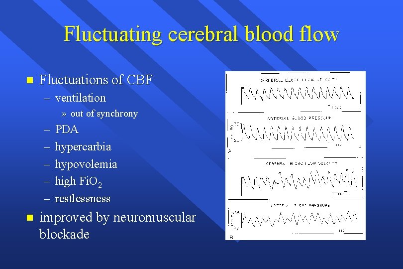 Fluctuating cerebral blood flow n Fluctuations of CBF – ventilation » out of synchrony