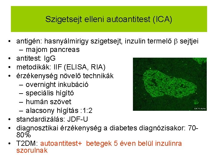 Szigetsejt elleni autoantitest (ICA) • antigén: hasnyálmirigy szigetsejt, inzulin termelő sejtjei – majom pancreas