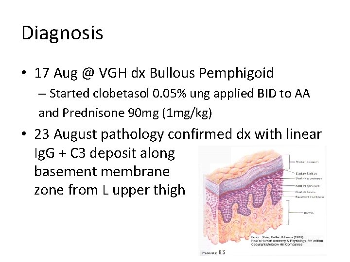 Diagnosis • 17 Aug @ VGH dx Bullous Pemphigoid – Started clobetasol 0. 05%