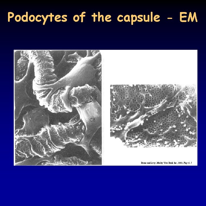 Podocytes of the capsule - EM Berne and Levy, Mosby Year Book Inc, 1993,