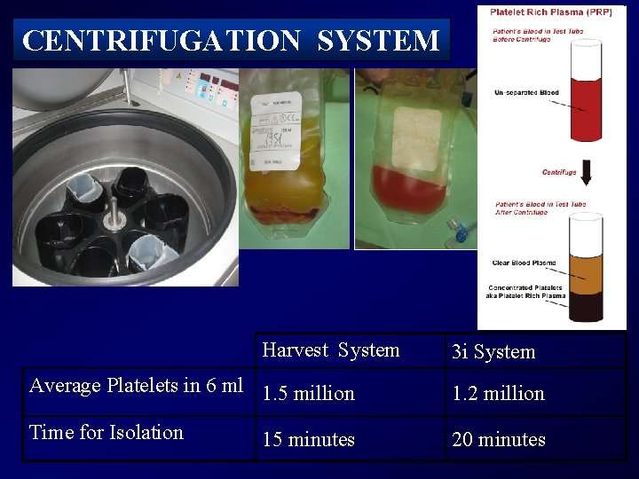 CENTRIFUGATION SYSTEM Harvest System 3 i System Average Platelets in 6 ml 1. 5