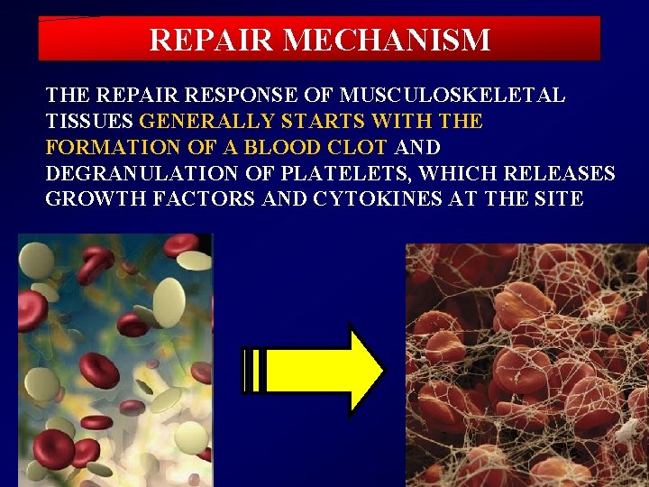 REPAIR MECHANISM THE REPAIR RESPONSE OF MUSCULOSKELETAL TISSUES GENERALLY STARTS WITH THE FORMATION OF