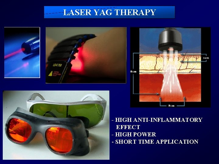 LASER YAG THERAPY - HIGH ANTI-INFLAMMATORY EFFECT - HIGH POWER - SHORT TIME APPLICATION