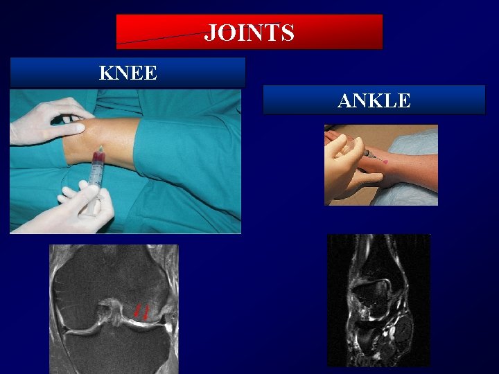 JOINTS KNEE ANKLE 