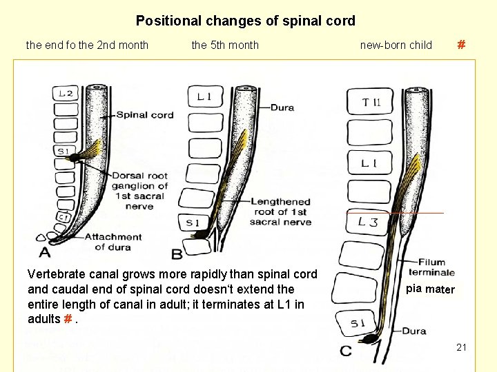 Positional changes of spinal cord the end fo the 2 nd month the 5