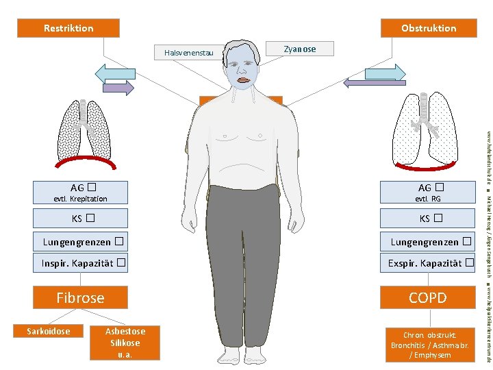 Restriktion Obstruktion Halsvenenstau Zyanose Chronisches Cor pulmonale KS � Lungengrenzen � Inspir. Kapazität �