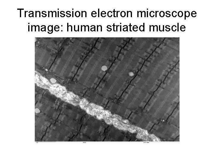Transmission electron microscope image: human striated muscle 