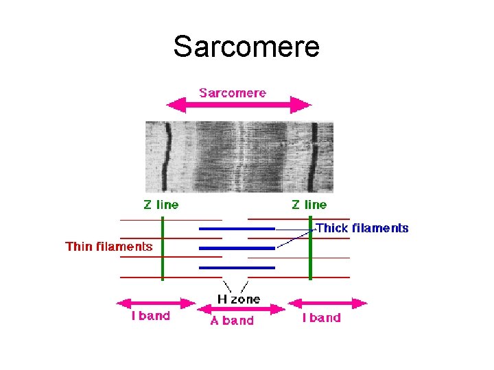 Sarcomere 