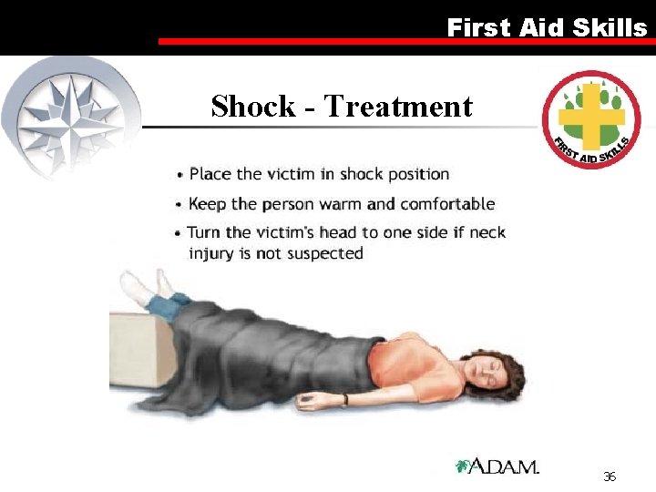 First Aid Skills Shock - Treatment 36 