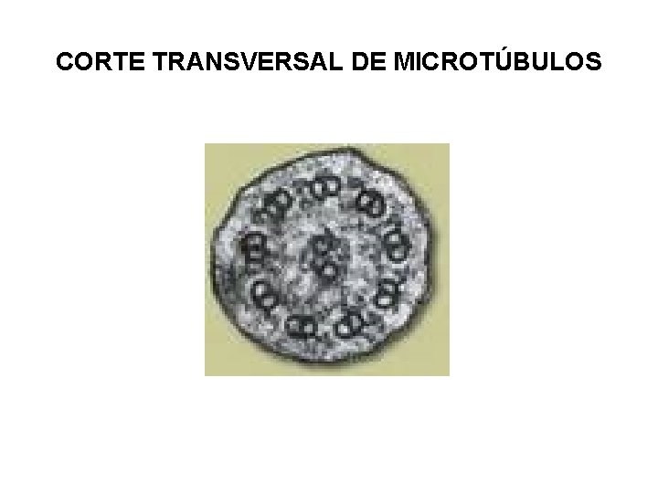 CORTE TRANSVERSAL DE MICROTÚBULOS 