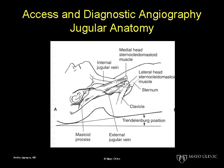 Access and Diagnostic Angiography Jugular Anatomy Andre Lapeyre, MD © Mayo Clinic 