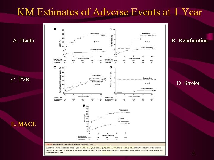 KM Estimates of Adverse Events at 1 Year A. Death B. Reinfarction C. TVR