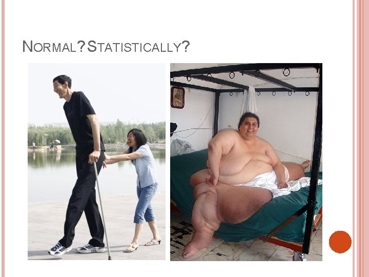 NORMAL? STATISTICALLY? 