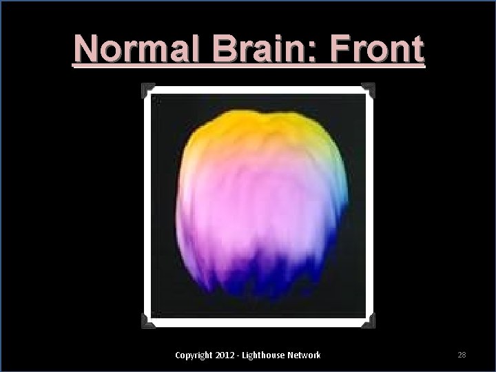 Normal Brain: Front Copyright 2012 - Lighthouse Network 28 