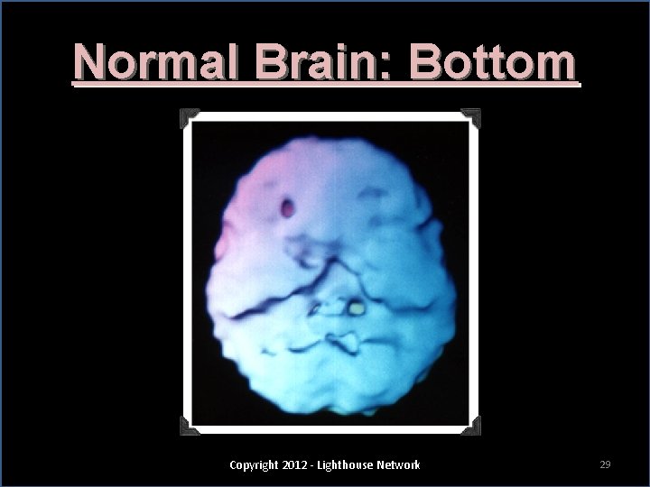 Normal Brain: Bottom Copyright 2012 - Lighthouse Network 29 