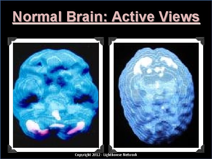 Normal Brain: Active Views Copyright 2012 - Lighthouse Network 30 