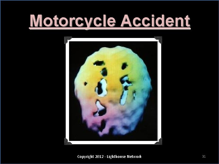 Motorcycle Accident Copyright 2012 - Lighthouse Network 31 
