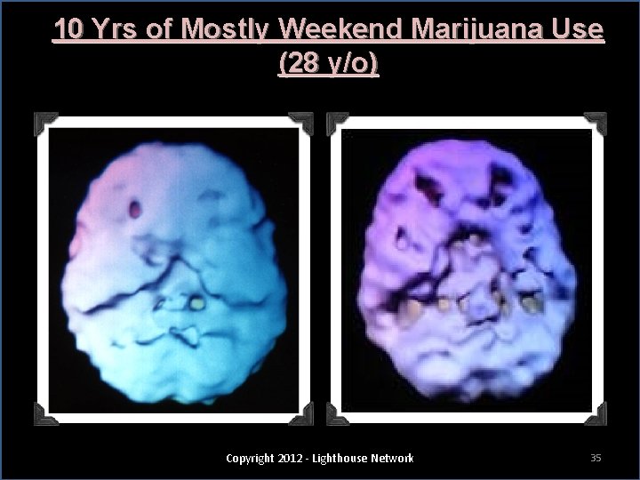 10 Yrs of Mostly Weekend Marijuana Use (28 y/o) Copyright 2012 - Lighthouse Network