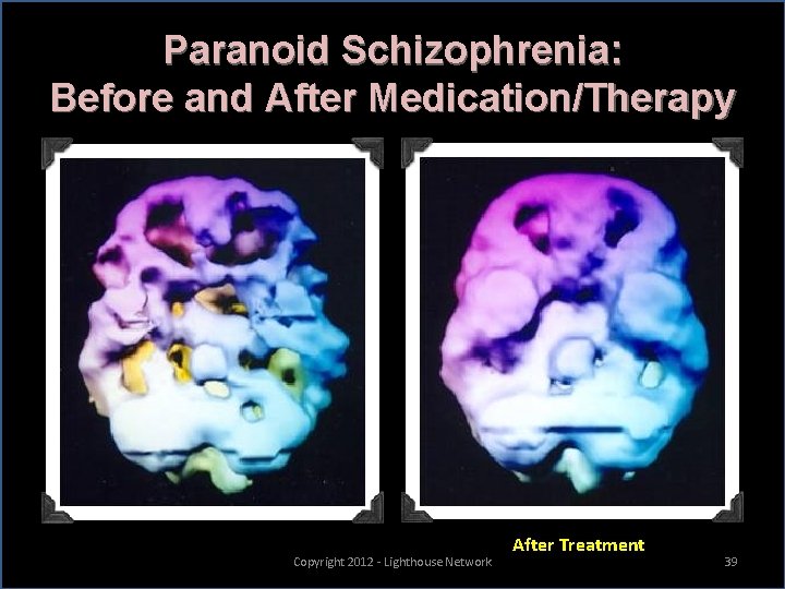 Paranoid Schizophrenia: Before and After Medication/Therapy Copyright 2012 - Lighthouse Network After Treatment 39