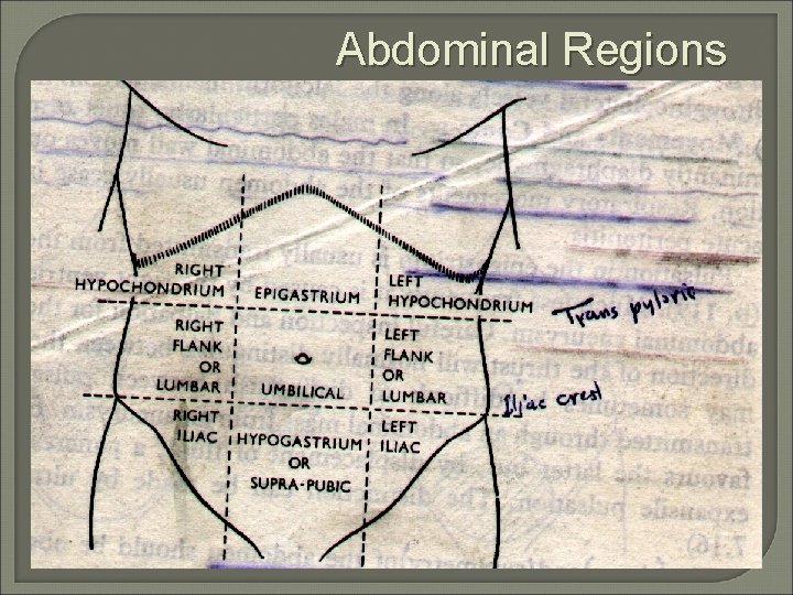 Abdominal Regions 