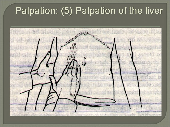 Palpation: (5) Palpation of the liver 