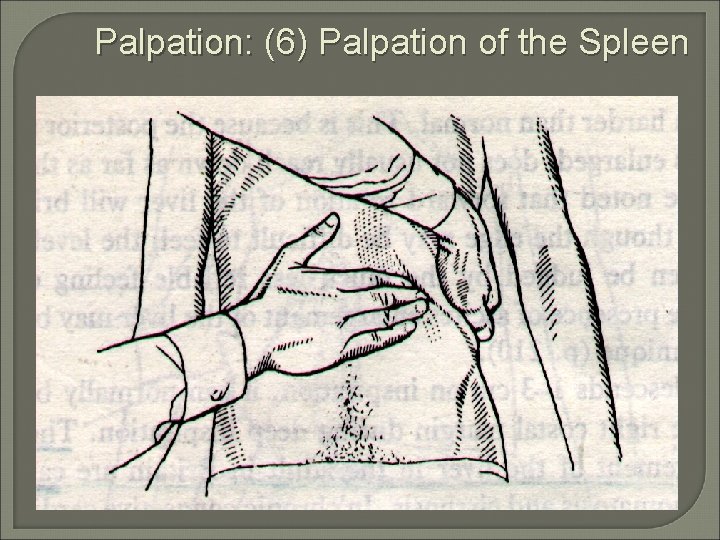 Palpation: (6) Palpation of the Spleen 