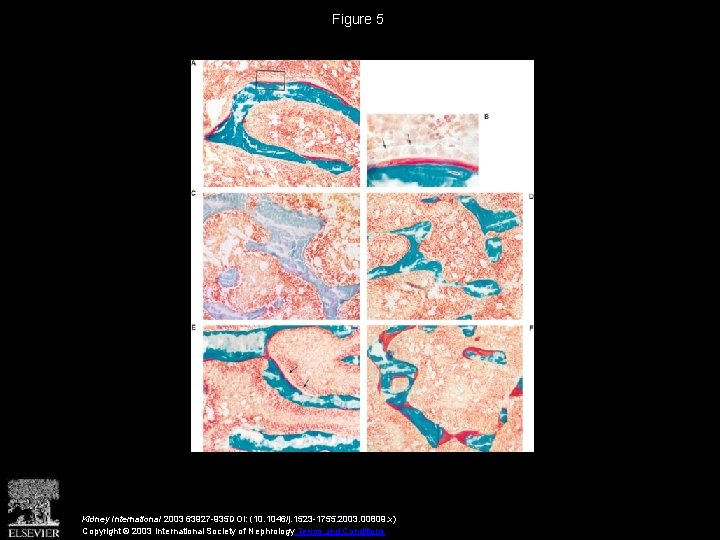 Dosedependent effects of strontium on bone of chronic