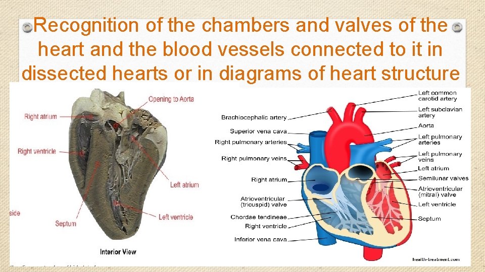Recognition of the chambers and valves of the heart and the blood vessels connected