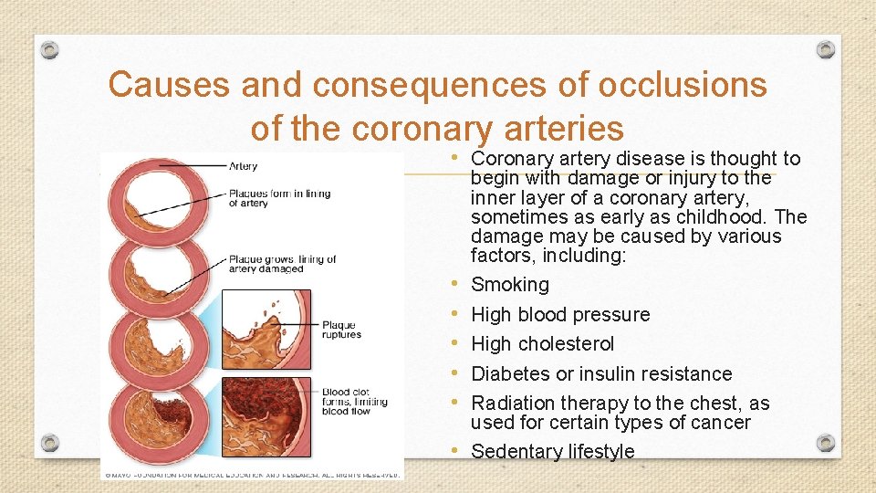 Causes and consequences of occlusions of the coronary arteries • Coronary artery disease is