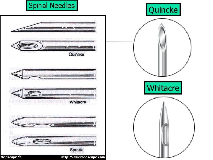 Spinal Needles Quincke Whitacre 