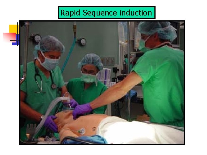 Rapid Sequence induction 