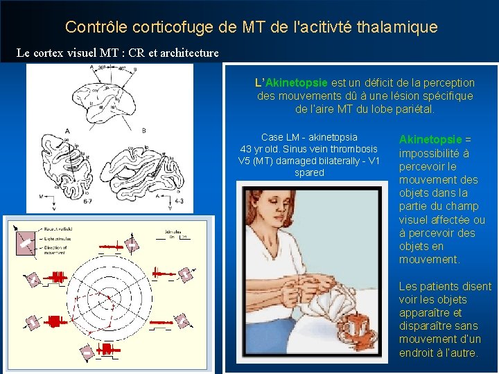Contrôle corticofuge de MT de l'acitivté thalamique Le cortex visuel MT : CR et