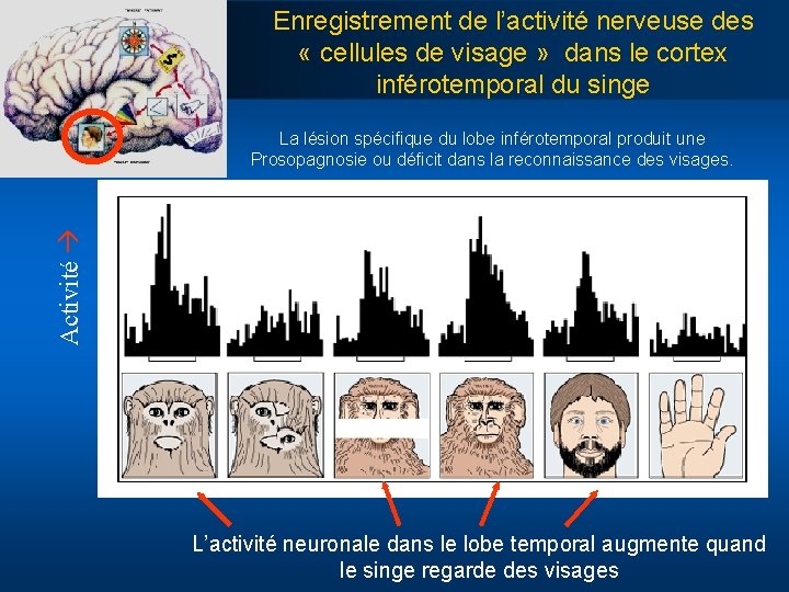 Enregistrement de l’activité nerveuse des « cellules de visage » dans le cortex inférotemporal