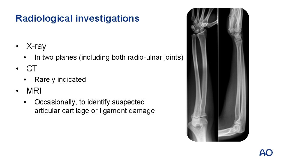 Radiological investigations • X-ray • In two planes (including both radio-ulnar joints) • CT