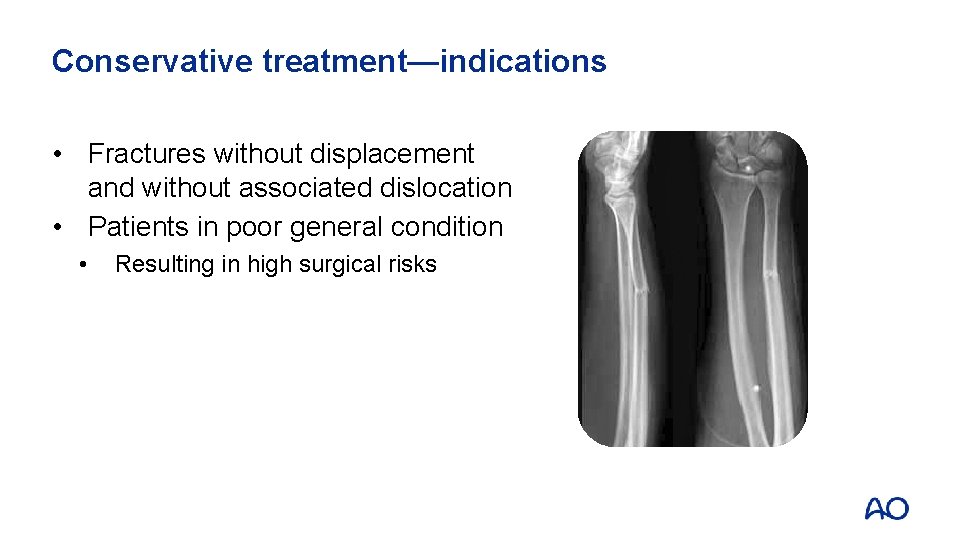 Conservative treatment—indications • Fractures without displacement and without associated dislocation • Patients in poor