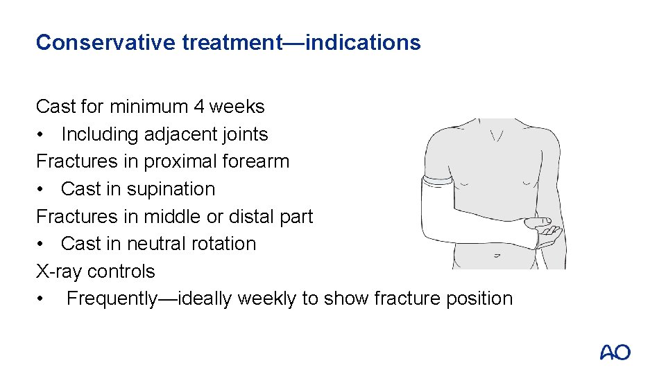 Conservative treatment—indications Cast for minimum 4 weeks • Including adjacent joints Fractures in proximal