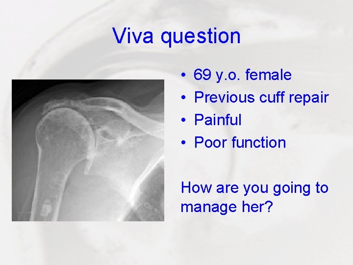 Viva question • • 69 y. o. female Previous cuff repair Painful Poor function