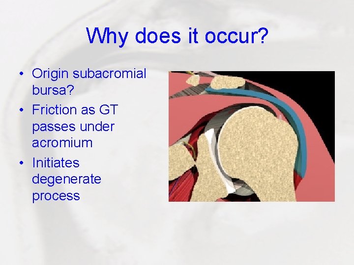 Why does it occur? • Origin subacromial bursa? • Friction as GT passes under