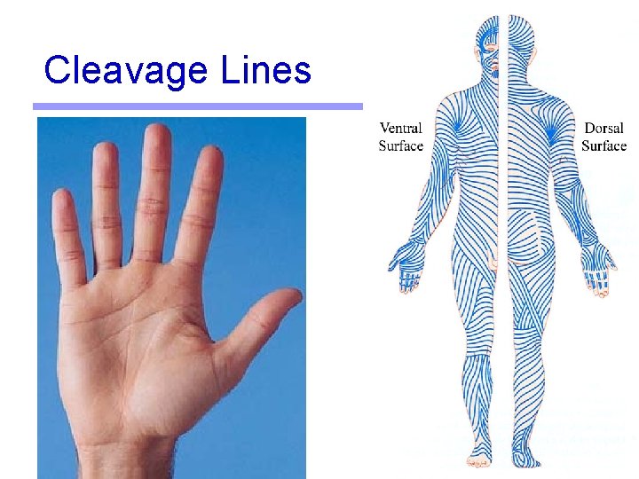 Cleavage Lines 11 Cleavage Lines 11