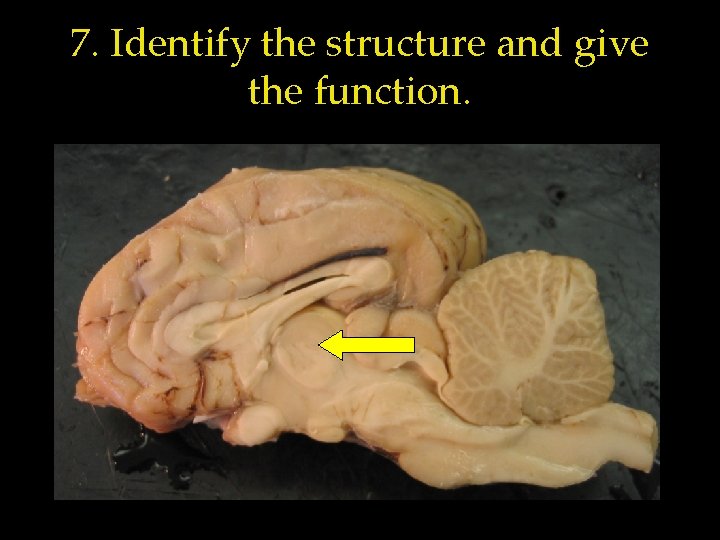 7. Identify the structure and give the function. 