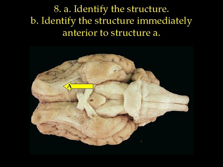 8. a. Identify the structure. b. Identify the structure immediately anterior to structure a.