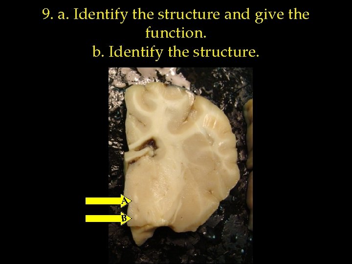 9. a. Identify the structure and give the function. b. Identify the structure. A