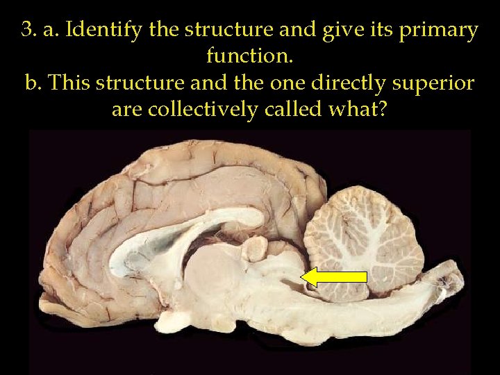 3. a. Identify the structure and give its primary function. b. This structure and