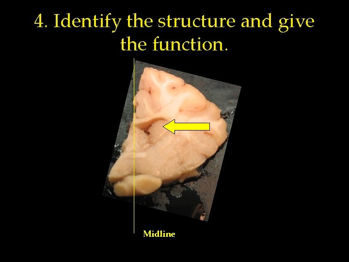 4. Identify the structure and give the function. Midline 