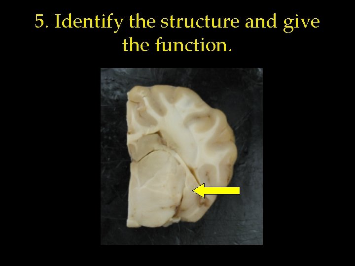 5. Identify the structure and give the function. 