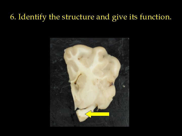 6. Identify the structure and give its function. 