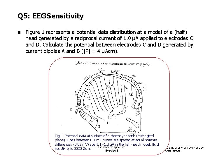 Q 5: EEG Sensitivity n Figure 1 represents a potential data distribution at a